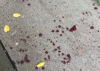 Késelés történt Vácon  – videóval