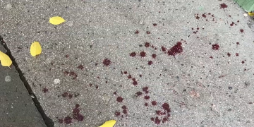 Késelés történt Vácon  – videóval